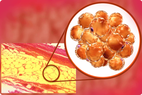 why img2